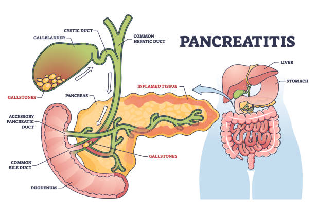 Liver Cirrhosis Treatment in Pune
