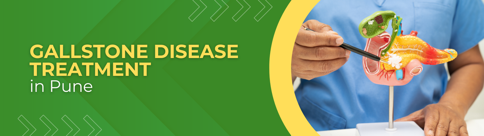 Gallstone Disease Treatment