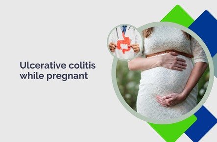 Ulcerative colitis while pregnant