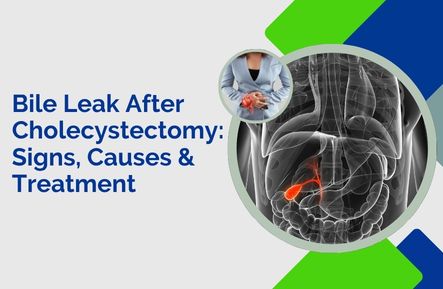 Bile Leak After Cholecystectomy – Causes, Symptoms & Treatments