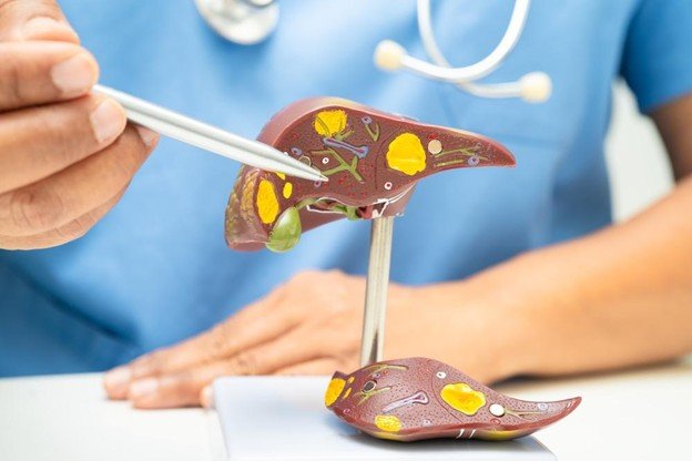 Stage 1 Liver Failure