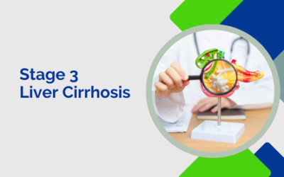 Stage 3 Liver Cirrhosis: Understanding the Condition