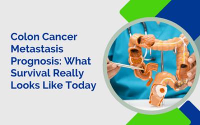 Colon Cancer Metastasis Prognosis: What Survival Really Looks Like Today