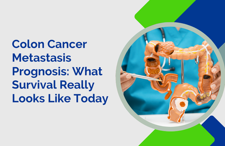 Colon Cancer Metastasis Prognosis: What Survival Really Looks Like Today