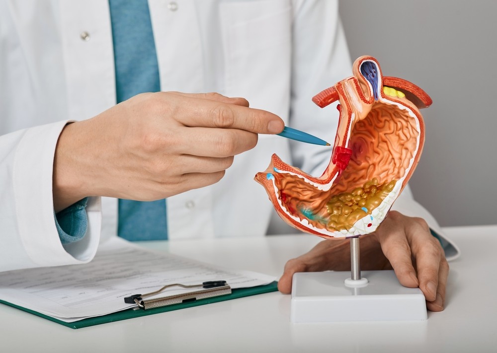 Medical professional in a white coat points to a cross‑section model of the human stomach using a blue pointer, on a stand beside a clipboard.