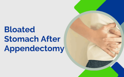 Bloated Stomach After Appendectomy
