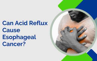 Can Acid Reflux Cause Esophageal Cancer?