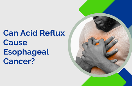 Can Acid Reflux Cause Esophageal Cancer?