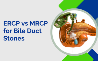 ERCP vs MRCP: Which Test Do You Need for Bile Duct Stones?