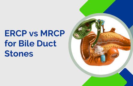 ERCP vs MRCP: Which Test Do You Need for Bile Duct Stones?