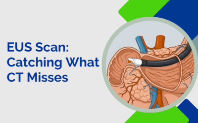 How Does an EUS Scan Catch What a CT Misses?