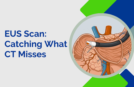 How Does an EUS Scan Catch What a CT Misses?