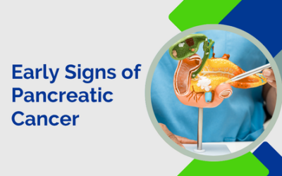 What Are the Early Signs of Pancreatic Cancer?