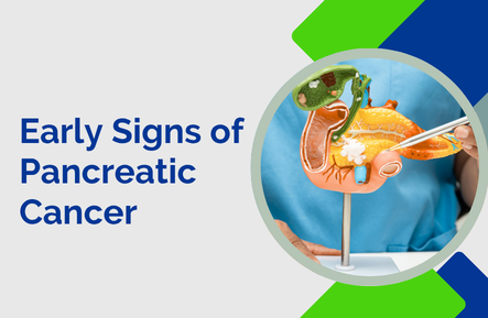 What Are the Early Signs of Pancreatic Cancer?