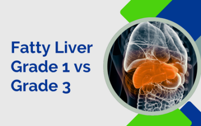 Fatty Liver Grade 1 vs Grade 3: Can Both Be Reversed?
