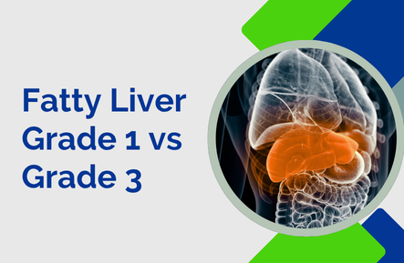 Fatty Liver Grade 1 vs Grade 3: Can Both Be Reversed? 