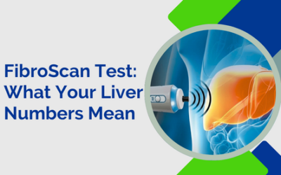 What Do FibroScan Numbers Actually Mean for Your Liver?