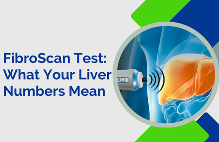 What Do FibroScan Numbers Actually Mean for Your Liver?