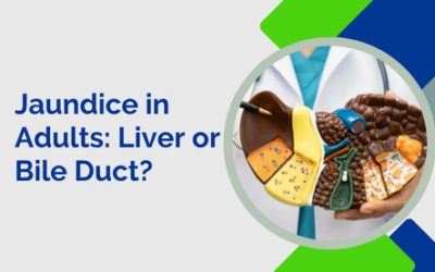 Jaundice in Adults: Is It the Liver or the Bile Duct?