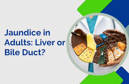 Jaundice in Adults: Is It the Liver or the Bile Duct?