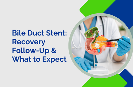 Bile Duct Stent:Recovery,Follow-Up and What to Expect