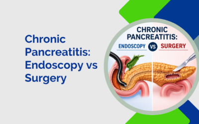 Chronic Pancreatitis: Endoscopy vs Surgery?