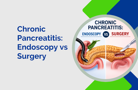 Chronic Pancreatitis: Endoscopy vs Surgery?