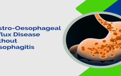 Gastro-Oesophageal Reflux Disease Without Oesophagitis