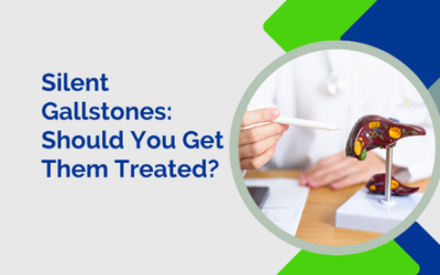 Silent Gallstones: Should You Get Them Treated?