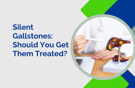 Silent Gallstones: Should You Get Them Treated?
