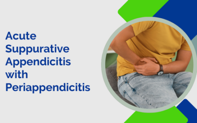 Acute Suppurative Appendicitis with Periappendicitis