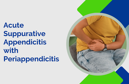 Acute Suppurative Appendicitis with Periappendicitis