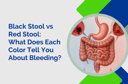 Black Stool vs Red Stool: What Does Each Color Tell You About Bleeding