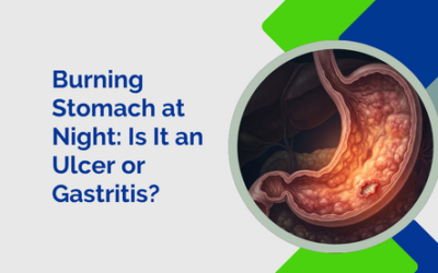 Burning Stomach at Night: Is It an Ulcer or Gastritis?