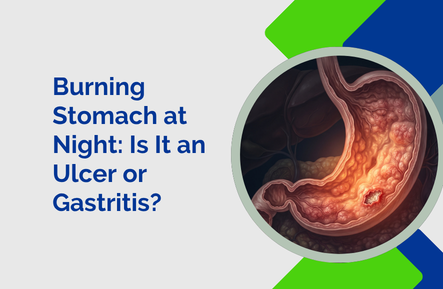 Burning Stomach at Night: Is It an Ulcer or Gastritis?