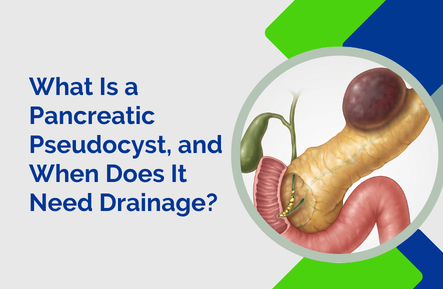 Header card: 'What Is a Pancreatic Pseudocyst, and When Does It Need Drainage?' beside a circular illustration of the pancreas.