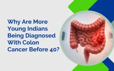 Why Are More Young Indians Being Diagnosed With Colon Cancer Before 40?
