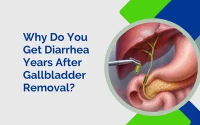 Why Do You Get Diarrhea Years After Gallbladder Removal?