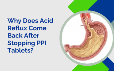 Why Does Acid Reflux Come Back After Stopping PPI Tablets?