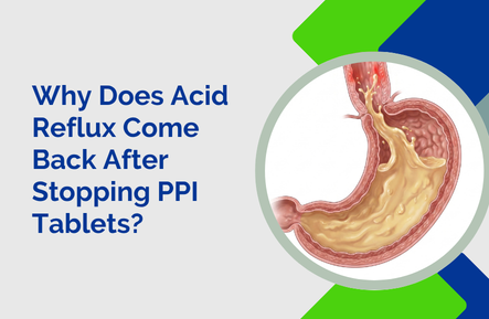Why Does Acid Reflux Come Back After Stopping PPI Tablets