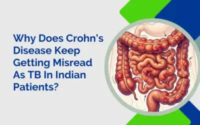 Why Does Crohn’s Disease Keep Getting Misread As TB In Indian Patients?