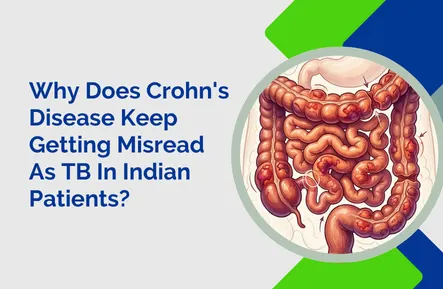 Why Does Crohn’s Disease Keep Getting Misread As TB In Indian Patients?