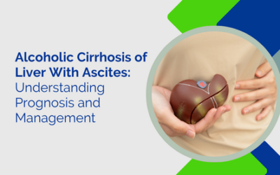 Alcoholic Cirrhosis of Liver With Ascites: Symptoms, Causes & Treatment