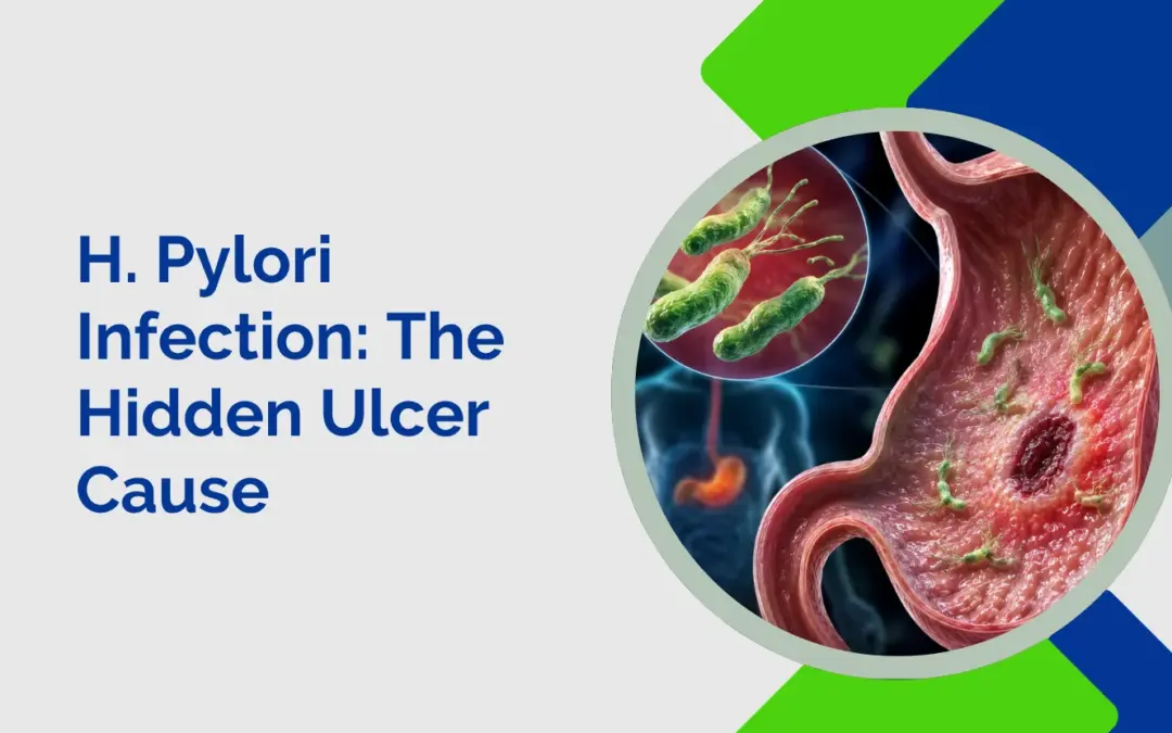 H Pylori Infection The Hidden Ulcer Cause