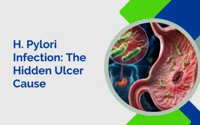 H. Pylori Infection: The Hidden Ulcer Cause