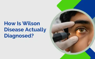 How Is Wilson Disease Actually Diagnosed?