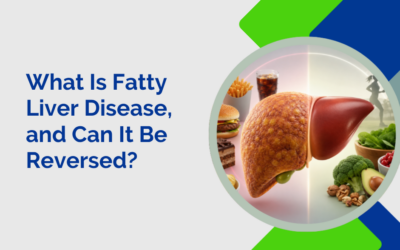 What Is Fatty Liver Disease, and Can It Be Reversed?