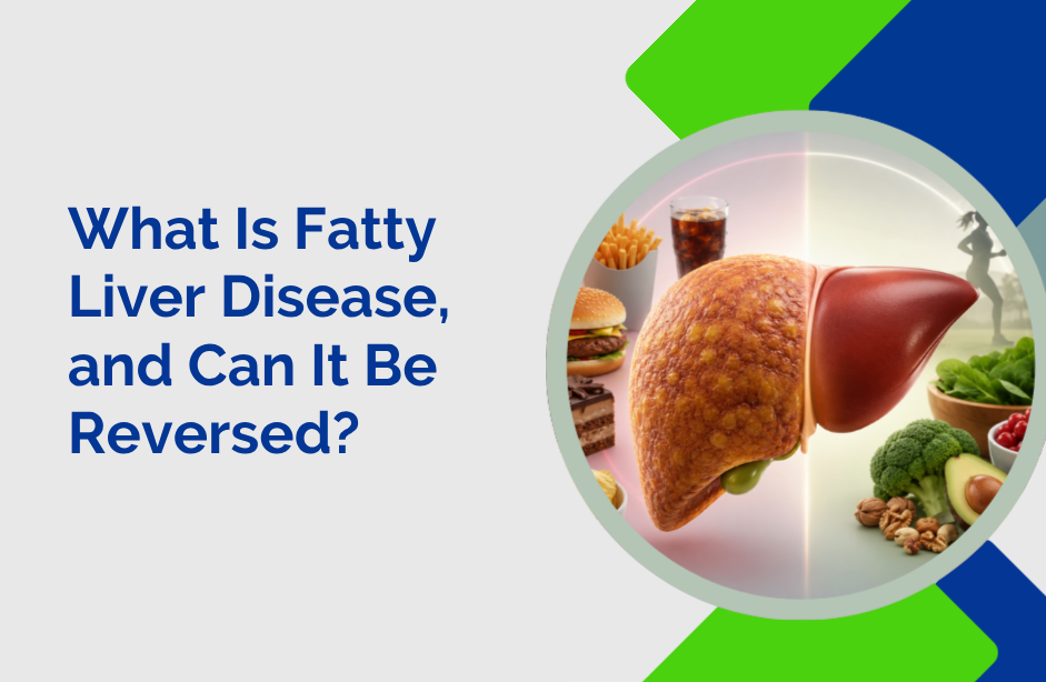 What Is Fatty Liver Disease and Can It Be Reversed