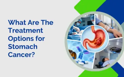 What Are The Treatment Options for Stomach Cancer?