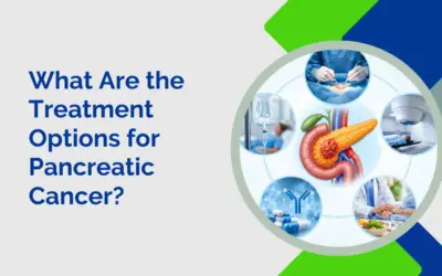 What Are the Treatment Options for Pancreatic Cancer?